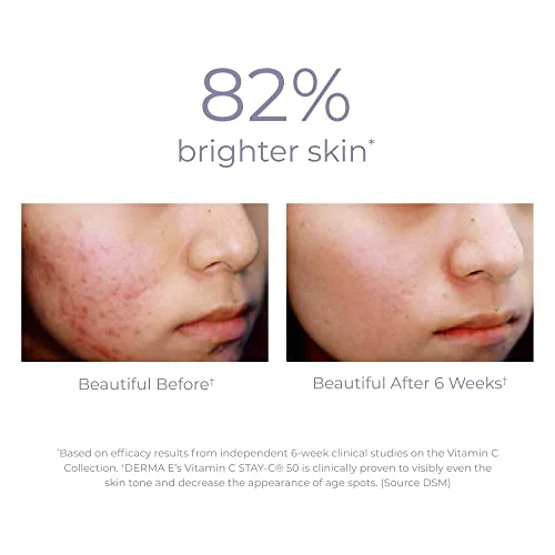 Derma E Vitamin C Cleanser - Brightening & Hydrating, Natural Ingredients - 6 fl oz - Image 7